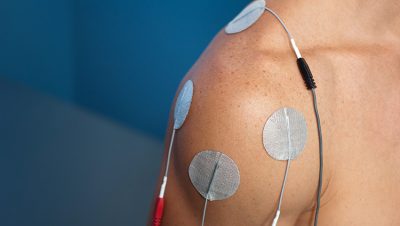 interferential current therapy12